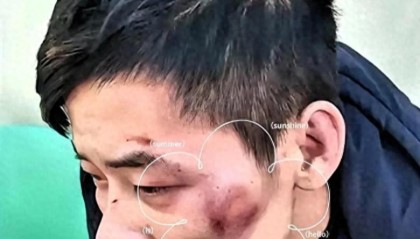 世界杯八强赛程-太猖狂！四川凌晨追打事件后续：6人一锅端，被查女子蛮横袭警